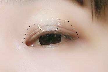 整形專家李長賦做雙眼皮效果好不好？