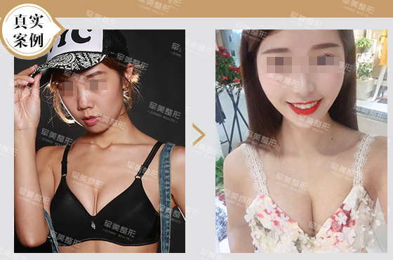 曾令宇經典案例