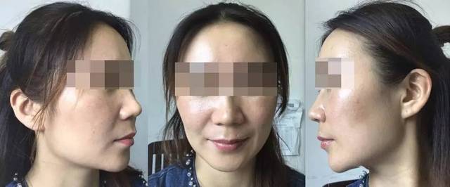 楚向杰線雕案例