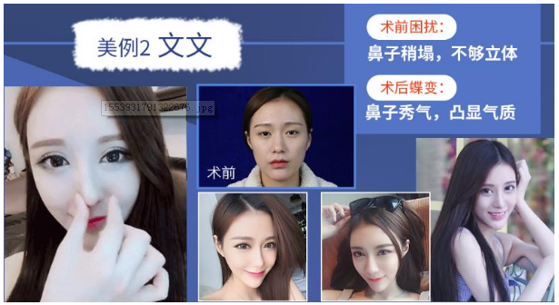 歐陽春隆鼻案例