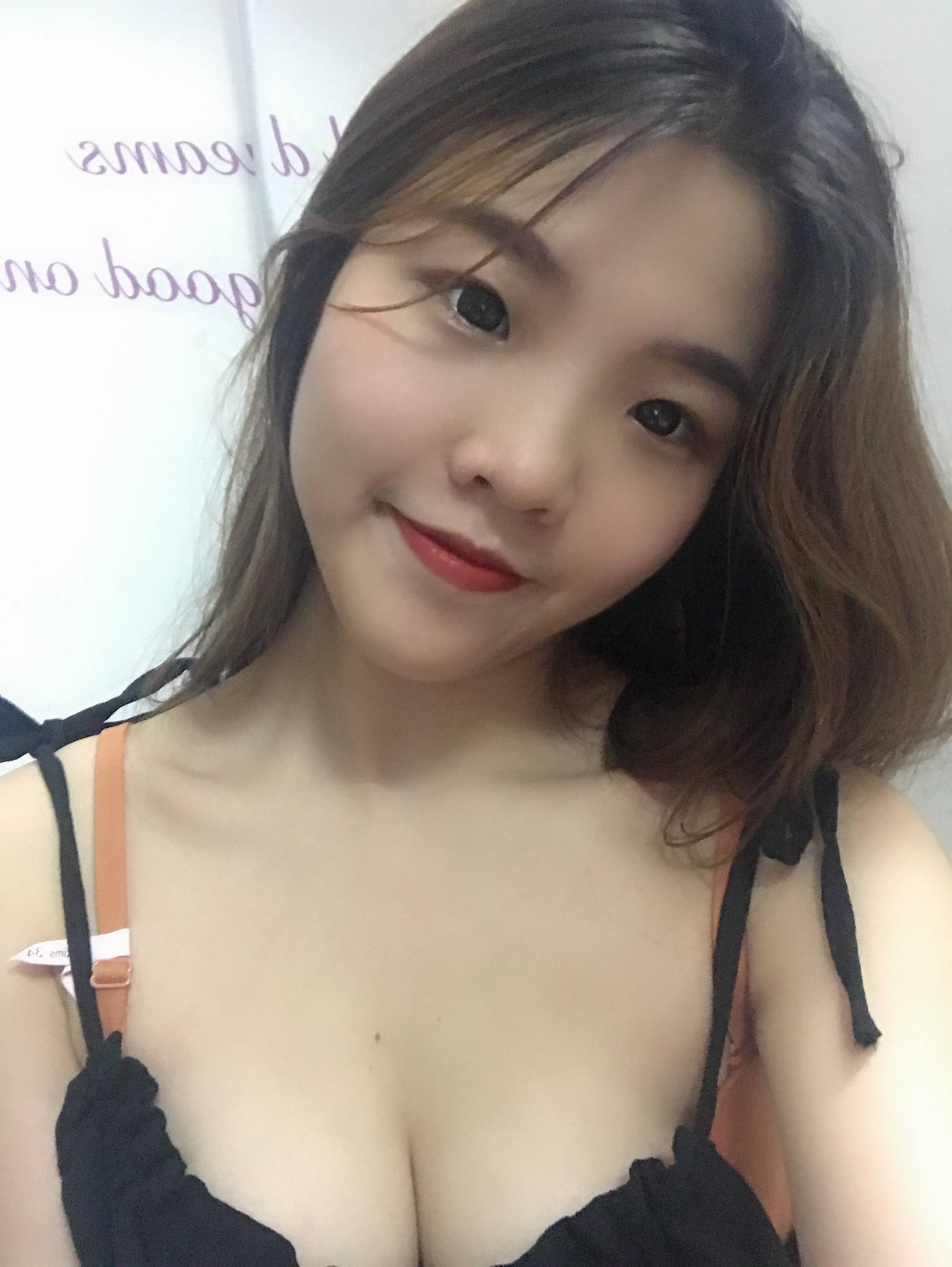 鄭州脂肪豐胸專家有哪些，大概費用多少？