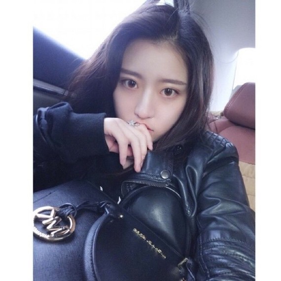 馬桂娥吸脂案例