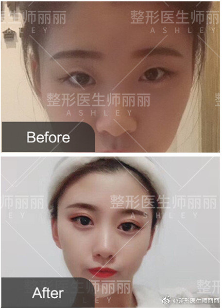 師麗麗眼綜合案例