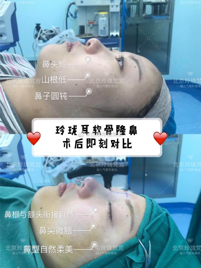 王光輝鼻子案例