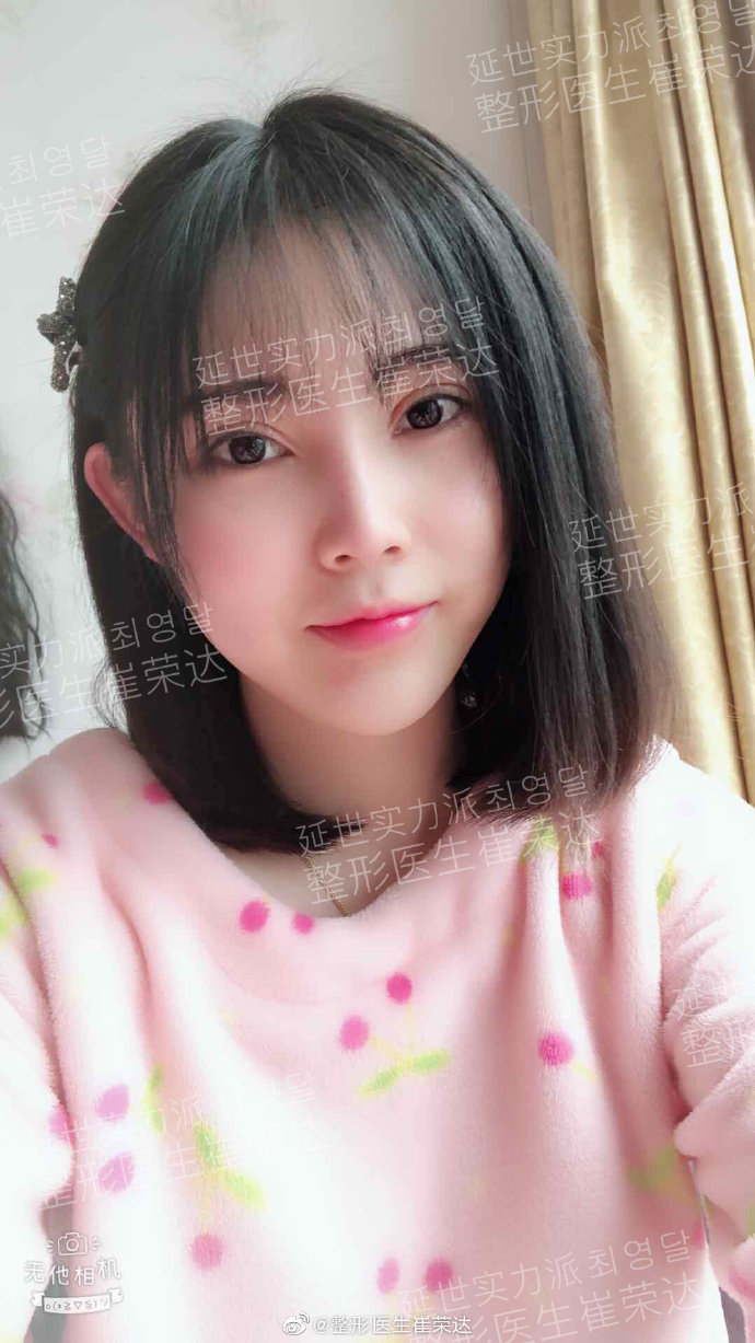 崔榮達(dá)磨骨案例