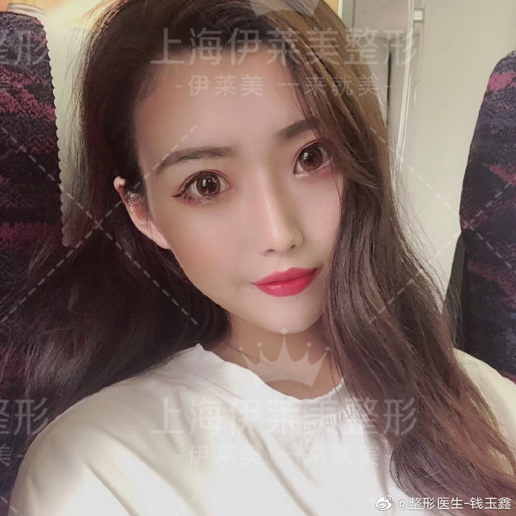 錢玉鑫