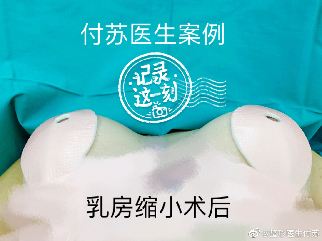 付蘇醫(yī)生案例
