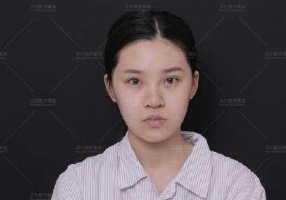 劉彥軍鼻修復案例