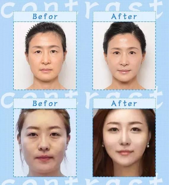 北京哪個醫(yī)生面部提升修復(fù)手術(shù)做的好