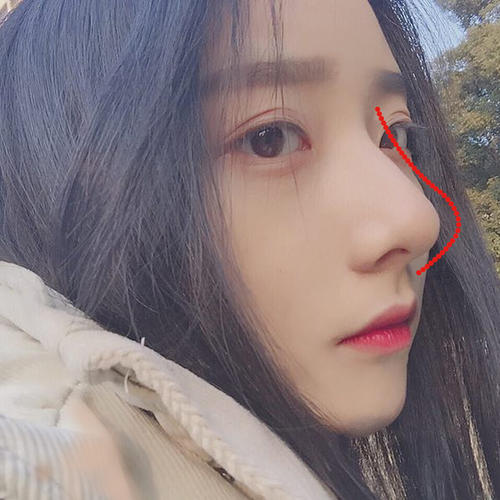 成都鼻綜合出名的醫(yī)生是哪個(gè)？