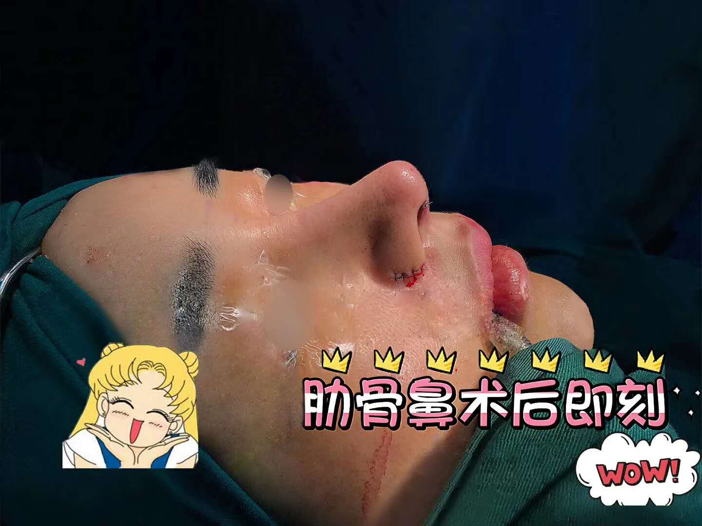 北京隆鼻專家前十名，北京隆鼻醫生排行榜