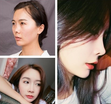 上海做鼻子最好的醫(yī)生是哪個(gè)？