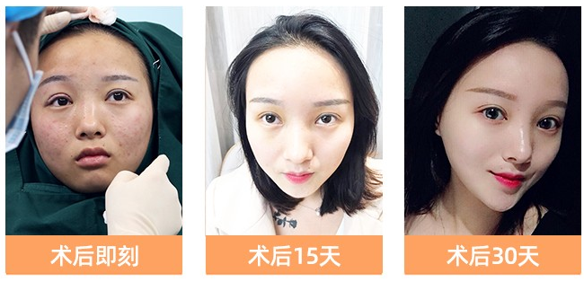 深圳眼綜合哪個(gè)醫(yī)院比較好？眼綜合哪個(gè)醫(yī)生做的好？