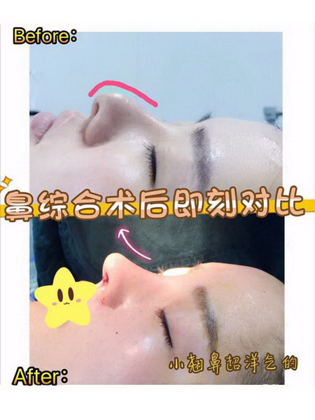  北京八大處鼻子誰做得好？北京八大處鼻綜合醫生