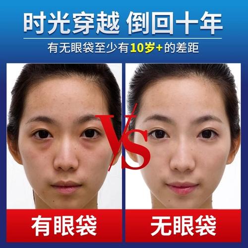 上海九院祛眼袋哪位專家技術好？