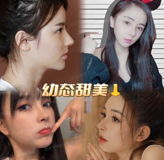 成都做鼻修復(fù)哪個(gè)醫(yī)院醫(yī)生好