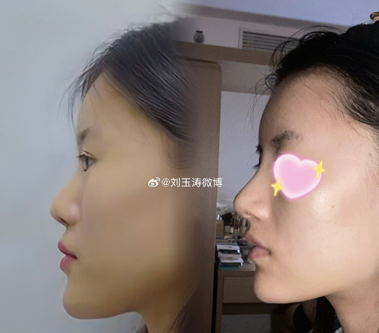 上海劉玉濤和戴傳昌哪個(gè)做鼻修復(fù)更好