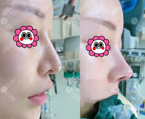 北京鼻修復(fù)王英勇和巫文云誰做得好